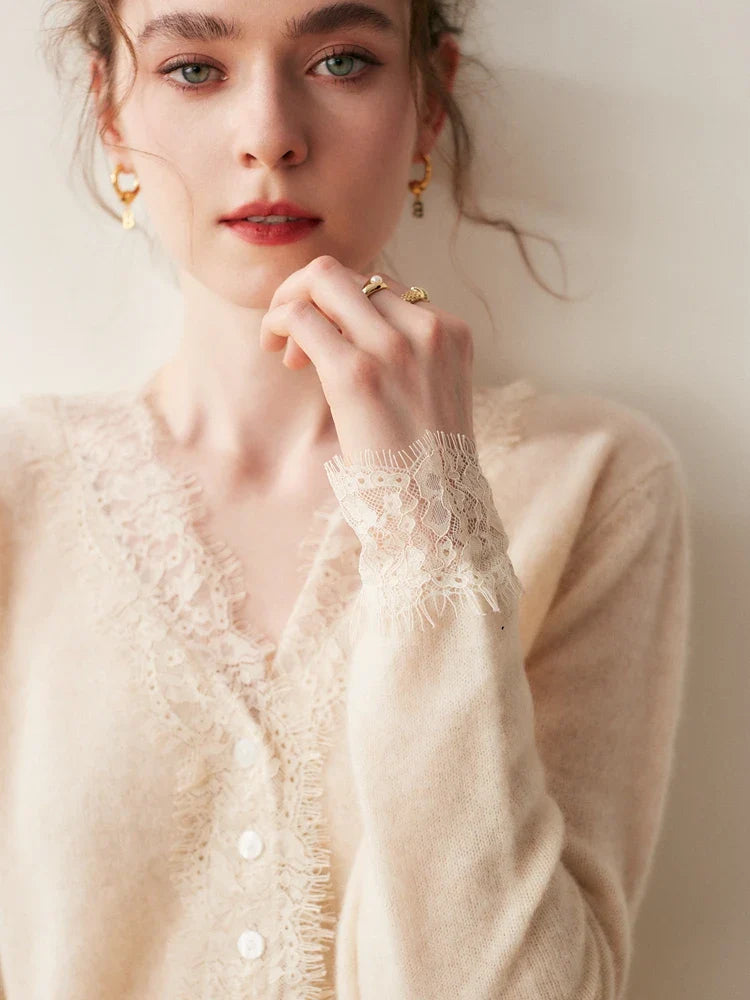 Rosie Fitted Cardigan | Lace Trim Button Front Cardigan