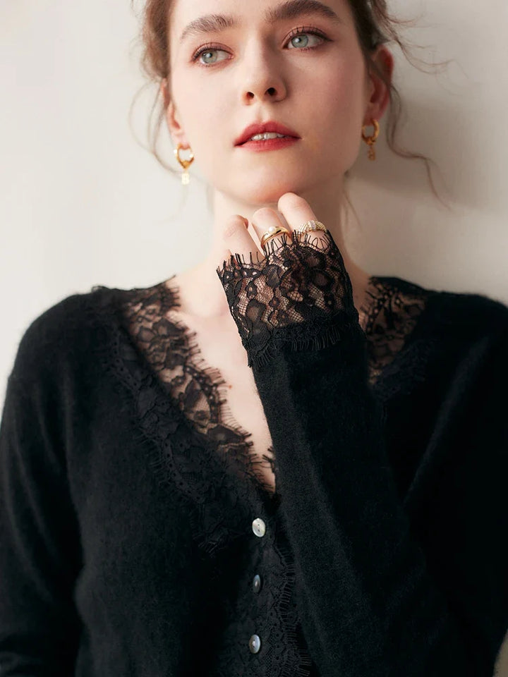 Rosie Fitted Cardigan | Lace Trim Button Front Cardigan